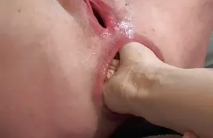 XXX மார்பளவு சிவப்புநிறம்